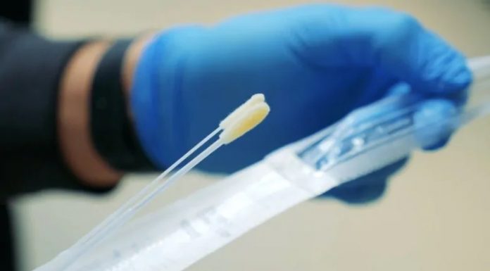 If in doubt, the CISSS des Laurentides encourages the population to take a screening test