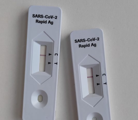 CCITB hands out rapid test kits for SMEs