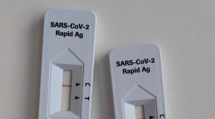CCITB hands out rapid test kits for SMEs