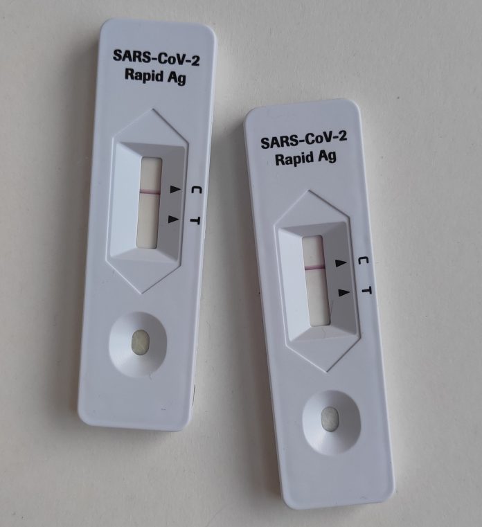 CCITB hands out rapid test kits for SMEs
